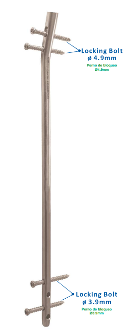 DAKSH Universal Tibia Nail